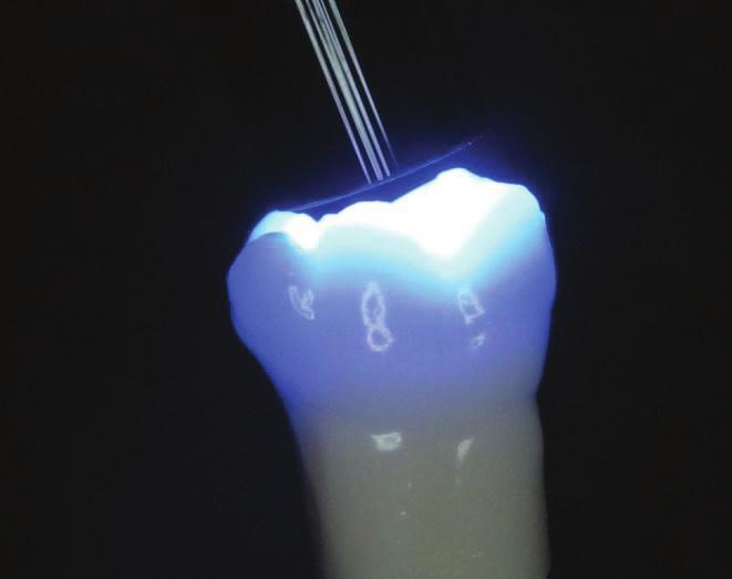 550 1550 mw/cm² Place light tip as straight and close as possible on tooth Curing of each layer according to recommended curing time Do not exceed recommended layer