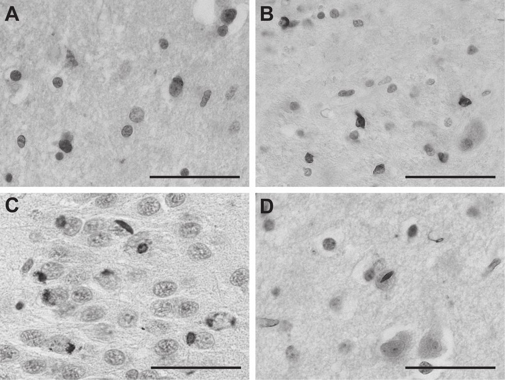 TDP-43 pathology in Familial Frontotemporal Dementia and Motor Neuron Disease without Progranulin mutations Figure 3 Chapter 4 Ub-positive neuronal cytoplasmatic inclusions were found in the caudatus