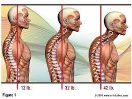 Anatomical Description The prime muscles that are responsible for posture are known as erector spinea.