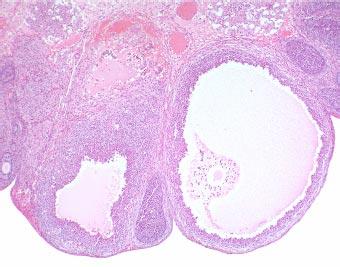 As observed in control cyclic females, rats treated with the selective COX-1 inhibitor displayed no alterations of the ovulatory process, with a preserved number of effective ovulations (i.e., oocytes released at the oviduct) and no oocytes being trapped in corpora lutea or released to the ovarian stroma.