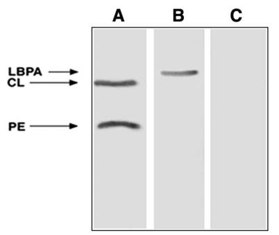 SERONEGATIVE APS TLC immunostaining SN-APS pts=36 acl + in 47.2% of SN-APS albpa + in 41.7% of SN-APS ape + in 30.