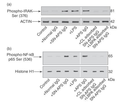 SERONEGATIVE APS Other results: IgG from SN-APS induce IRAK phosphorylation and NF-kB activation (a) IgG from SN-APS