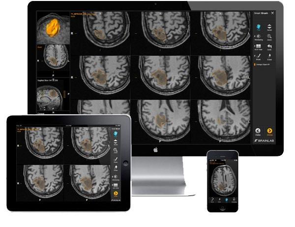 REACH FOR ANY DEVICE INTERCONNECTED AND INDEPENDENT Offering the freedom to work online on preferred devices including ipad and iphone, or offline on a workstation, Brainlab Elements fits into the