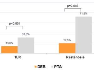 Treatment of SFA-ISR Drug Coated Balloons IN.PACT ISR (E.Stabile et al. JACC 2012) DEBATE ISR (F.Liistro et al. JEVT 2014) FAIR (H.Krankenberg LINC 2014) 39-Patient Registry 92.2% Primary Patency 92.