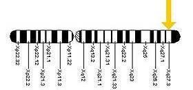 FMR1 gene X chromosome FMR1 (fragile X mental retardation 1) gene located on the long (q) arm of the X chromosome at position 27.