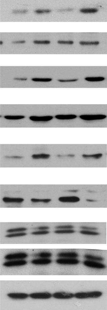 .3 Actin 3 2 1 Cytokine level (pg ml 1 ) FABP4//F4/8/DAPI FAS ATGL LPL 12 9 6 3 sirna SENP1 sirna IL-6 TNFα n.s. IFNγ IL-1β Figure 5 SENP1 deletion alters pancreatic adipocyte phenotype and augments NF-jB-dependent inflammation.