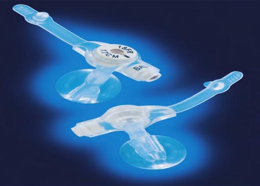 HALYARD* GASTROSTOMY FEEDING TUBES Medical Grade Silicone Construction Low-Profile Design Tapered Distal Tip Silicone Internal Retention Balloon Distal Tip Recessed at 5ml Proximal Anti-Reflux Valve