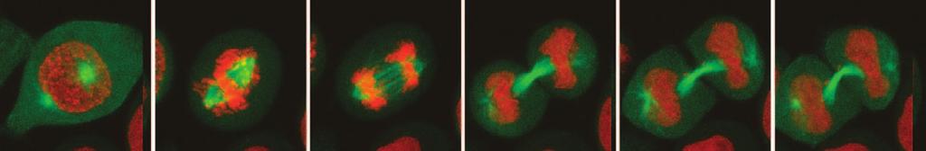 Knockdown of PKCe causes cells to enter anaphase prematurely when challenged by catenation.