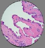 Resemble histiocytes but larger Enlarged