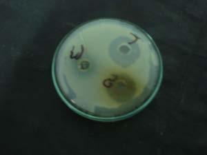 Showed that maximum antimicrobial activity of ethyl acetate lemon