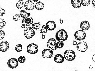 Figure 4-13. Variations in erythrocytes: a. Metarubricyte. b. Howell-Jolly bodies. (2) Cabot's rings (ring bodies).