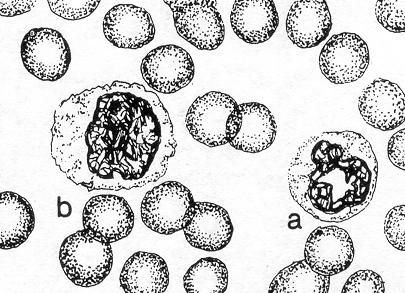c. Monocyte. See figure 4-29. Figure 4-29. Monocytic series: a. Neutrophil (late band). b. Monocyte. (1) Size. 14 to 20 microns in diameter. (2) Nucleus.