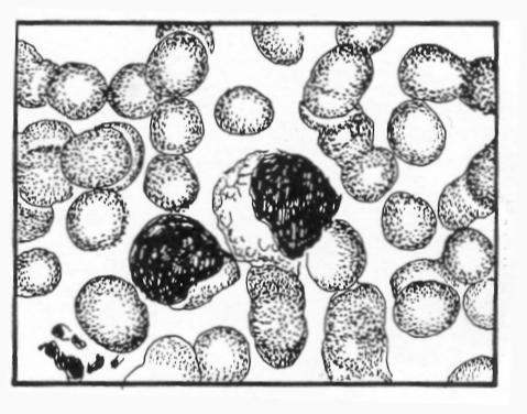 Figure 4-35. Variations in leukocytes: Atypical lymphocytes (infectious mononucleosis). (1) Size. Large, up to 20 microns in diameter. (2) Nucleus.