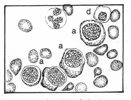 The cytoplasm is more abundant than in the precursor cells. It is blue-pink (polychromatic), the pink resulting from the first visible appearance of hemoglobin. Cytoplasmic granules are absent. d.