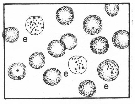 e. Reticulocyte (Polychromatic Erythrocyte). See figure 4-5. Figure 4-5. Erythrocytes series: Reticulocyte. (1) Size. 7 to 10 microns in diameter. (2) Nucleus. The nucleus is absent. (3) Cytoplasm.