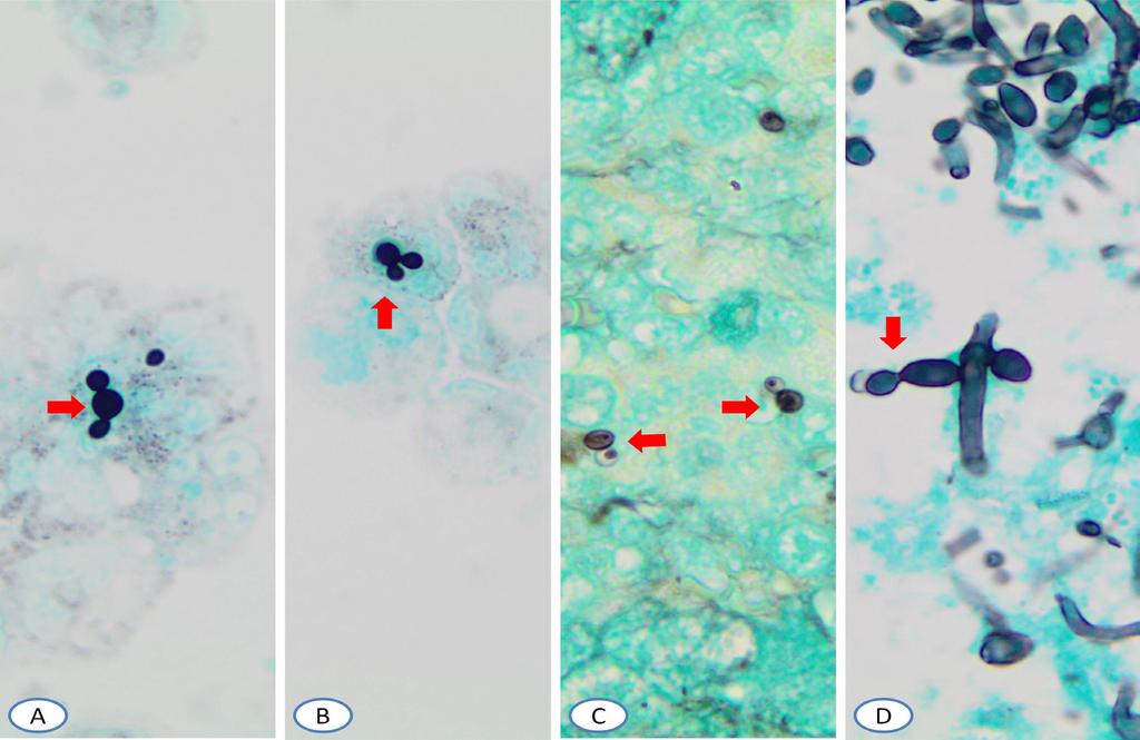 with GMA stain (D). Figure 3.