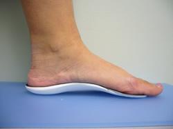 Dress shoe orthotic Plantar Fasciitis Platelet Rich Plasma Therapy: In cases of chronic plantar faciitis that is not responding to conservative care, a great inoffice option is platelet
