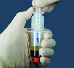 The idea of platelet rich plasma (PRP) injection is to allow the growth factors in the blood to be used to cause an inflammation process in the injured tissue to allow an increase in the