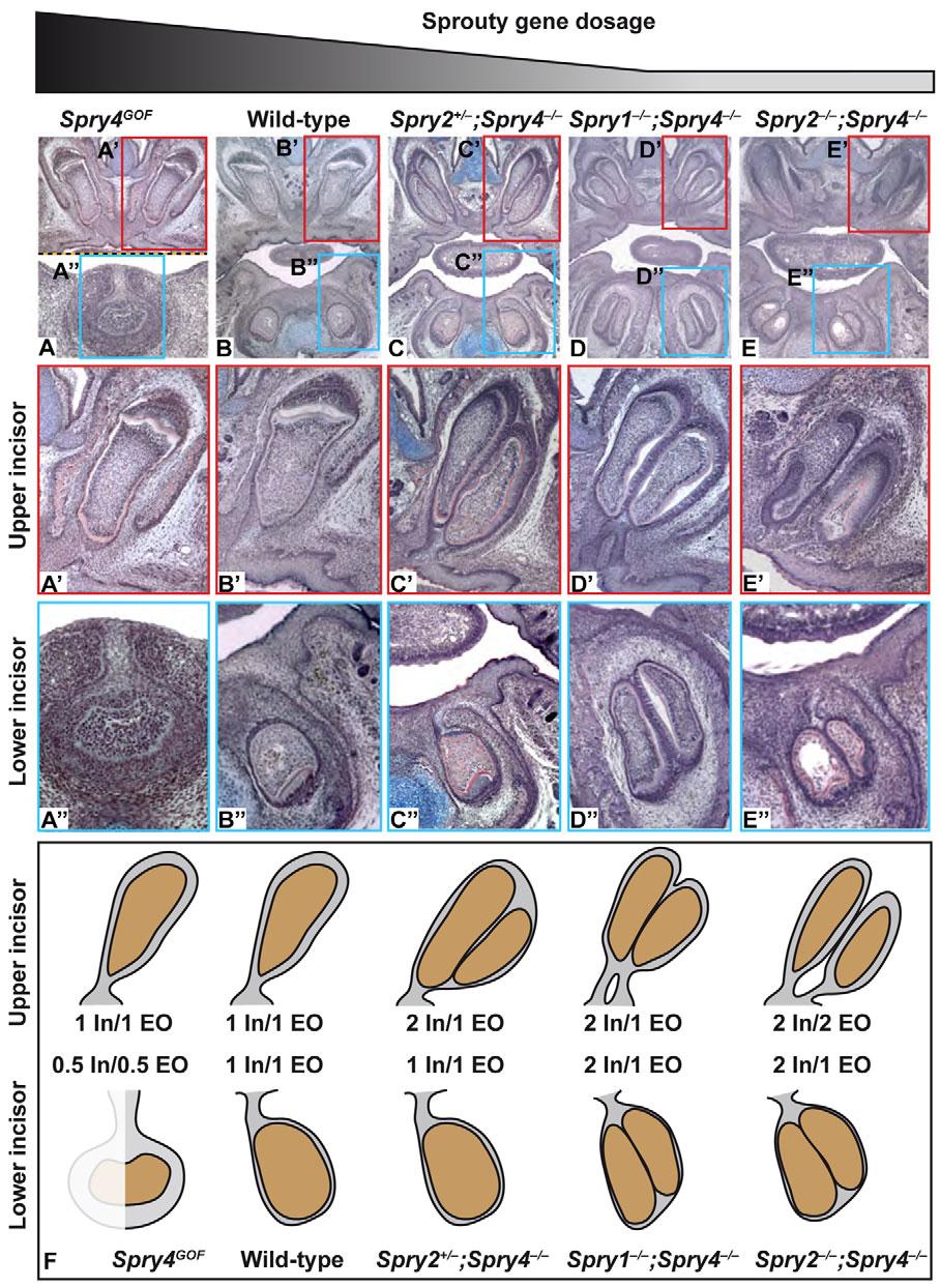 4070 RESEARCH ARTICLE Development 138 (18) Fig. 6. Incisor phenotypes in a Sprouty gene dosage series. (A-E) Frontal histological sections of embryonic head at E15.5 (A) and E18.