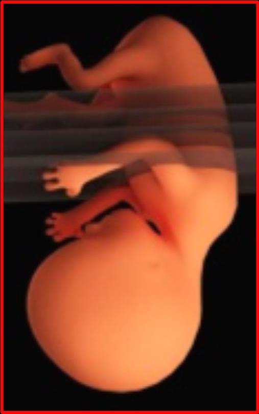 Determining Fetal Lie