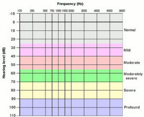 Clinical Audiogram (db HL ) db-hl (Hearing Level) uses a different reference level for each test frequency.