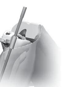 Note: Avoid applying excessive force anteriorly to the PSI Tibial Jig to prevent adding anterior slope.