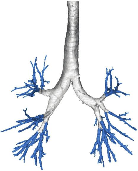 COPD L.A. DE BACKER ET AL. typically not sufficient to distinguish between the intraluminal and the alveolar air.