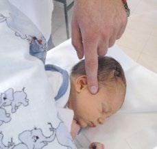 on the integrated electrodes Position the BERAphone ear cushion around the baby s ear, resting the