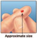 fingertip until a round drop of blood forms on your fingertip.