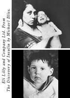 Before and After Insulin Treatment Discovery of insulin in 1921 changed type 1 from a