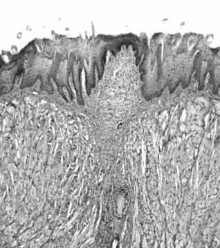 Figure 6 shows a cross section of the incised tongue tissue.