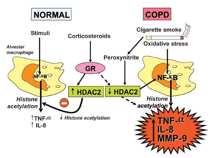 Reduced histone deacetylase in COPD - Mechanism for