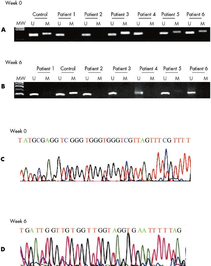 E-cadherin methylation and H pylori eradication 465 Figure 1 CpG island methylation pattern at the E-cadherin gene in gastric mucosa from patients with dyspepsia.