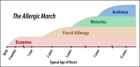 Good allergy practice Find the cause and prevent symptoms and disease progression, rather than just rely on