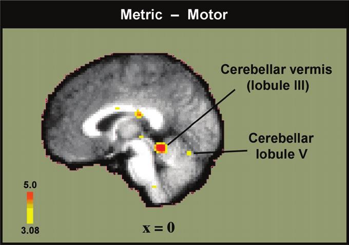 Brown Results A systems-level view of the brain areas contributing to comparatively natural, although supine, dance performance (Metric dancing minus Rest, Table 1) revealed activations in bilateral