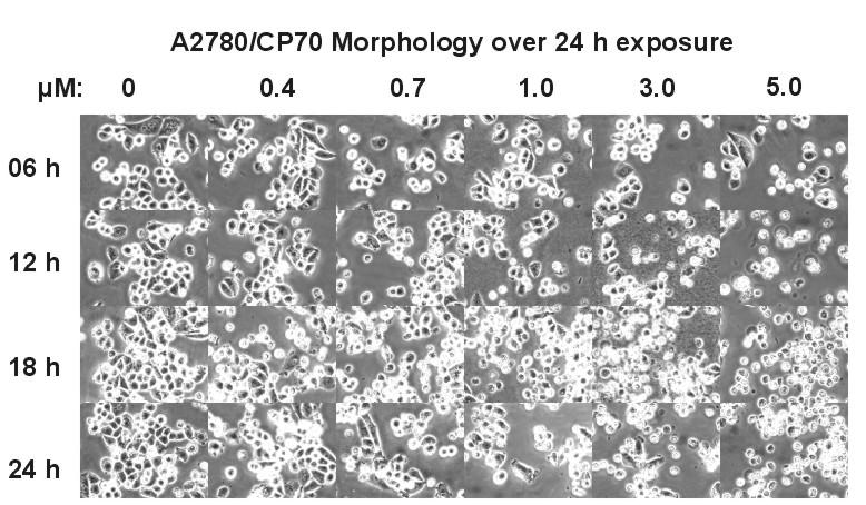 Figure 3. Visual assessment of Compound 10 in A2780/CP70.