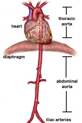 Thoracic Aortic Stent Graft Thoracic Aorta Anatomy The thoracic aorta runs from