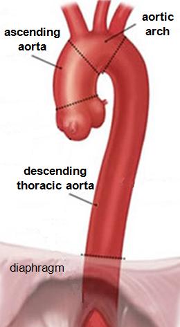 The precerebral arteries arise from the thoracic aortic arch.