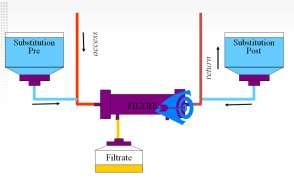 UF vs Qs: Filtration ratio Filtration ratio (FR) = (Post + Fluid loss) / Qs Exemple Qs : 250 ml/min = 15000 ml/h