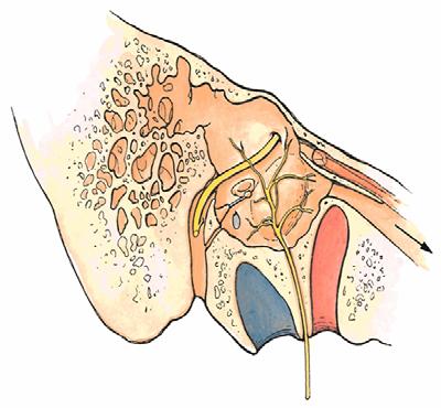 middle ear (i.e. on the promontory) Posterior Anterior Jugular foramen Figure 7.