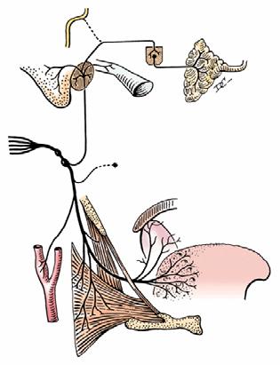 Diagrammatic Review Glossopharyngeal Nerve (CN IX) Glossopharyngeal nerve Lesser petrosal nerve Otic ganglion Parotid