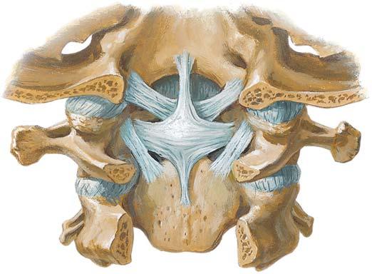 Craniovertebral Ligaments Clivus portion of occipital bone Alar ligaments Dens covered by cruciate ligament Transverse ligament of atlas Posterior view of the craniovertebral ligaments after removal