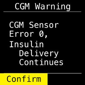 Troubleshooting. Sensor failed Sensor has shut off before end of 7-day session. Sensor ERR 0 Sensor cannot calibrate. Remove failed sensor and insert new Sensor.