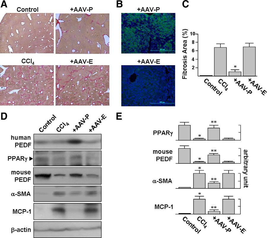 1804 Ho et al Figure 3. AAV-PEDF protects mice from CCl 4 - induced hepatic fibrosis. Mice were injected with AAV-PEDF for 1 week and then treated with CCl 4 twice per week for 3 weeks.
