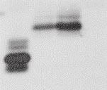 (B) Immunoprecipitation-Western blot analysis of core protein and HBeAg secreted to the culture supernatant. Clones K81 and 5.