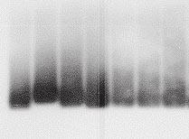 Huh7 cells were cotransfected with HBV constructs and SEAP cdna, and 8 g of RNA extracted at day 3 posttransfection was separated in a denaturing agarose gel.