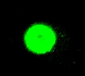 16h. The localization of cellular HMGB1 was measured by fluorescent immunostaining