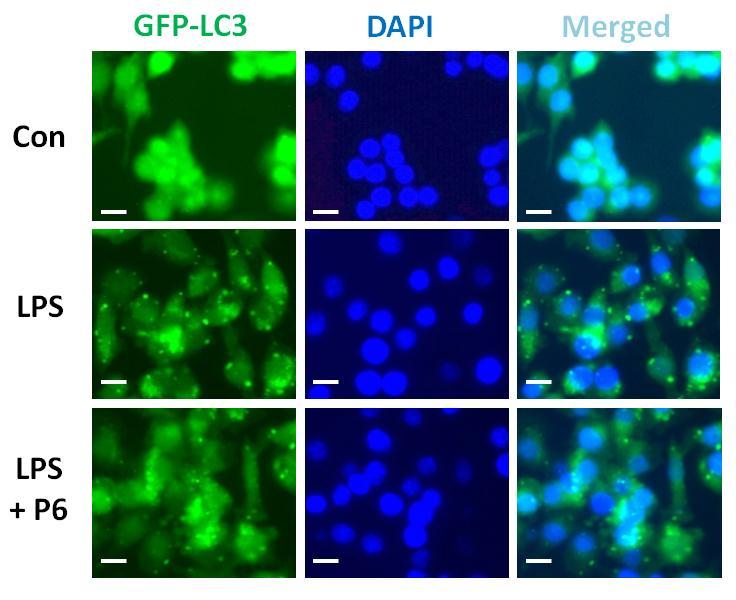 A B C Supplementary Fig. 5. RAW 267.4 cells that stably express GFP-LC3 were stimulated with LPS (1 µg/ml) for 16 h in the presence or the absence of pyridone 6 (P6).