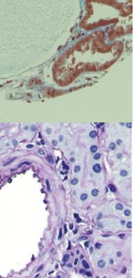(I K) PASstained sections showing detached cells in the