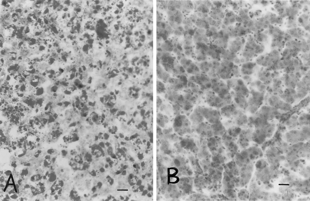 fed 5 mg aflatoxin B1/kg feed that reveled a severe and diffuse hepatic vacuolization (B). Bar equals 10 µm.